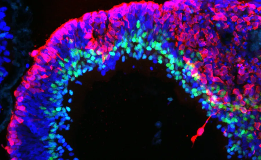 a human stem cell derived retinal organoid stained with antibodies for RECOVERIN (red, =photoreceptors) and AP2 (green, = amacrine cells). The lamination of the tissue and position of the cells is similar to a human retina. 